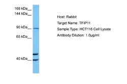 TFIP11 Antibody, Novus Biologicals 100 &mu;L; Unconjugated:Antibodies,